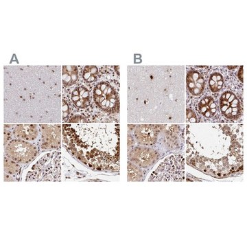 Anti-PSMD7 antibody produced in rabbit