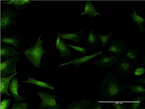 Monoclonal Anti-RP2, (C-terminal) antibody produced