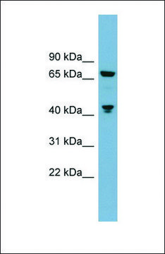 Anti-GLS antibody produced in rabbit