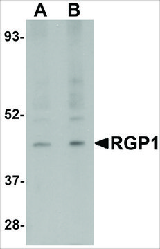 Anti-RGP1 antibody produced in rabbit
