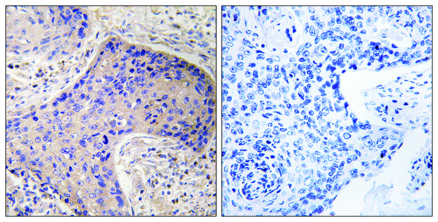 Anti-ST6GAL1 antibody produced in rabbit