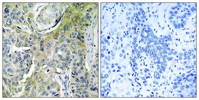 Anti-RHOBTB3 antibody produced in rabbit
