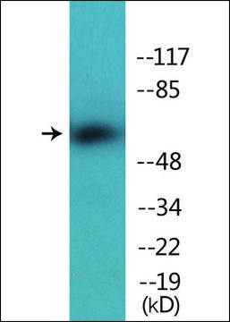 Anti-phospho-Chk2 (pThr³??) antibody produced in