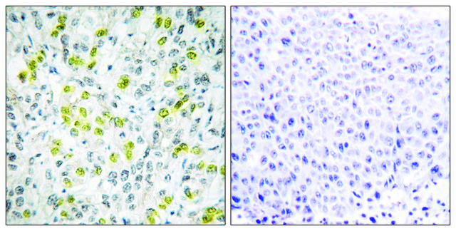 Anti-CHD4 antibody produced in rabbit