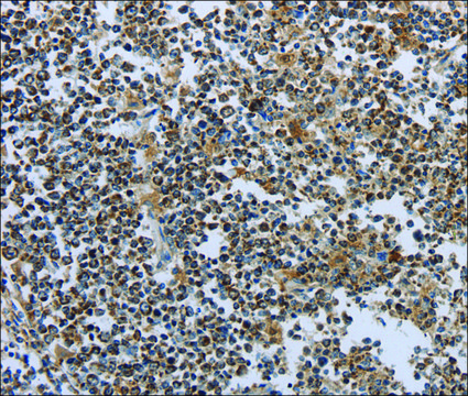 Anti-PTPRK antibody produced in rabbit