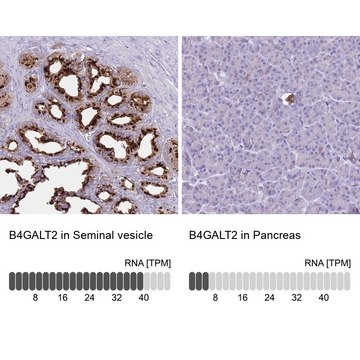 Anti-B4GALT2 antibody produced in rabbit