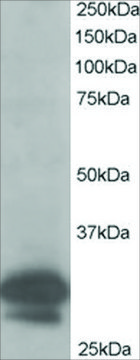 Anti-CAPZB antibody produced in goat