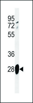 ANTI-ADM (CENTER) antibody produced in