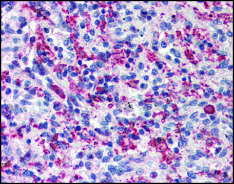 Anti-CARD11 antibody produced in rabbit