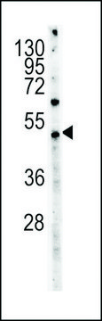 MONOCLONAL ANTI-MYC TAG antibody produced