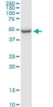 Anti-PPP2R2B antibody produced in rabbit