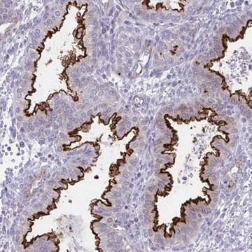 Anti-OR7A5 antibody produced in rabbit
