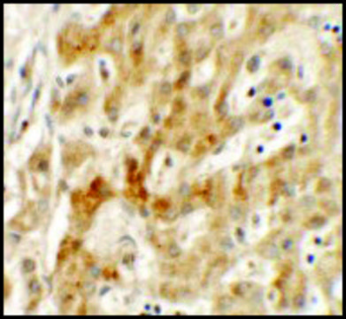 Anti-TMEM106B antibody produced in rabbit