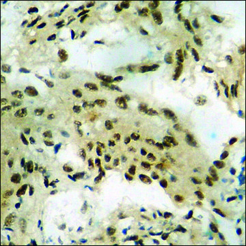 Anti-phospho-GR (pSer²?³) antibody produced in