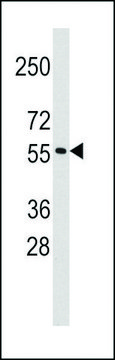 ANTI-RNF36 (TRIM69) (CENTER H215) antibody