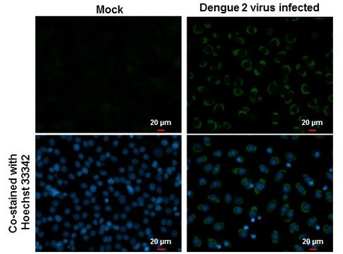 Monoclonal Anti-Dengue virus NS1 protein
