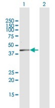 Anti-DHDH antibody produced in rabbit