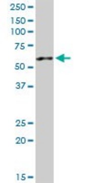 Anti-AP4M1 antibody produced in rabbit