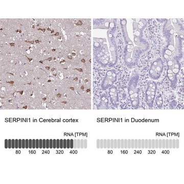Anti-SERPINI1 antibody produced in rabbit