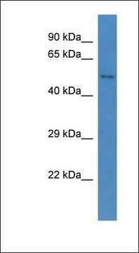 Anti-CCBE1 antibody produced in rabbit