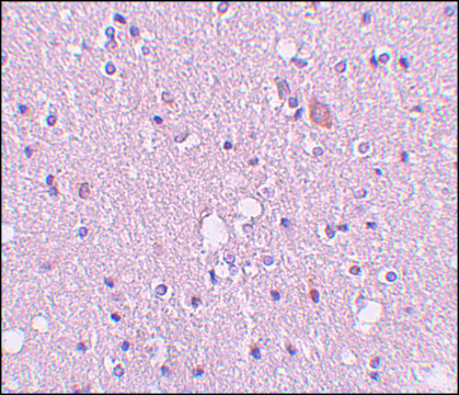 Anti-SIPA1L2 antibody produced in rabbit