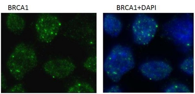 Monoclonal Anti-BRCA1 antibody produced in