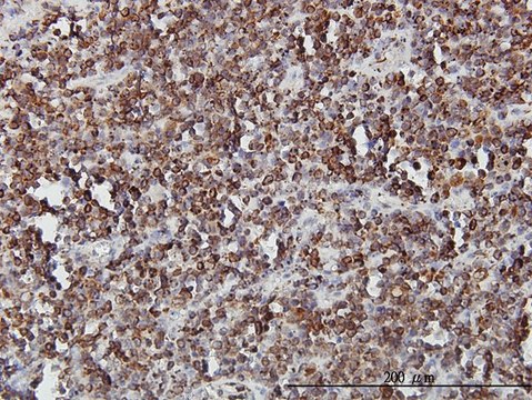 Monoclonal Anti-SLC44A2 antibody produced in