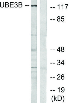 Anti-UBE3B antibody produced in rabbit