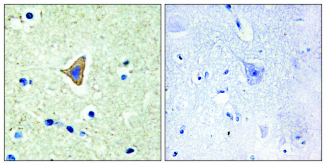 Anti-CDH20 antibody produced in rabbit
