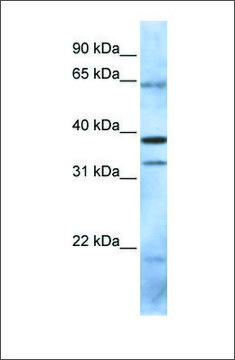 Anti-PCGF5 antibody produced in rabbit