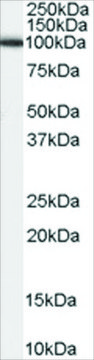 Anti-ADAM17/TACE antibody produced in goat