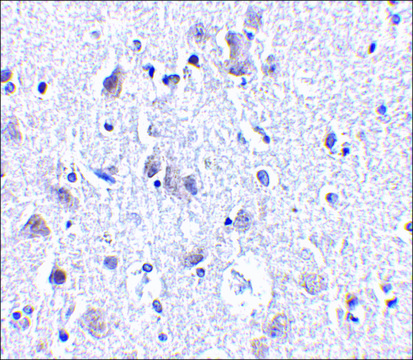 Anti-BRSK1 antibody produced in rabbit