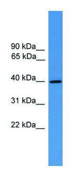 Anti-AVPR2 (C-terminal) antibody produced in