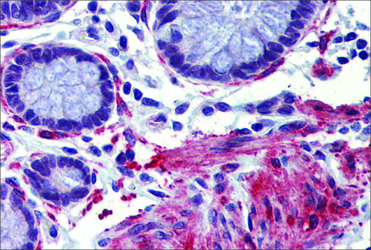 Anti-CREBBP antibody produced in rabbit