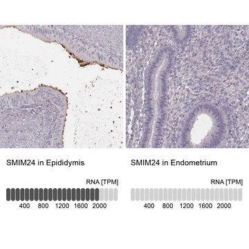 Anti-SMIM24 antibody produced in rabbit