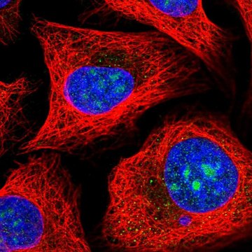 Anti-MPHOSPH10 antibody produced in rabbit