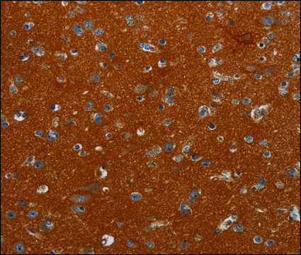 Anti-NOX3 antibody produced in rabbit