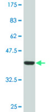 Monoclonal Anti-DSCR1 antibody produced in