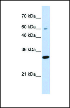 Anti-LRRC57, (N-terminal) antibody produced in