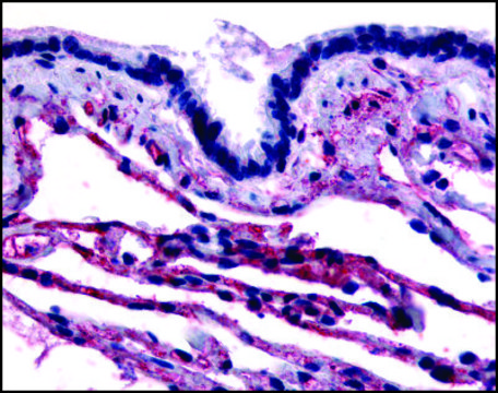 Anti-CAV1 (AB2) antibody produced in