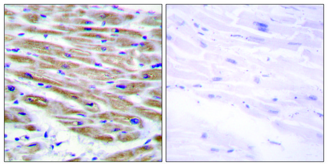 Anti-MAP3K4 antibody produced in rabbit