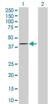 Anti-FBXO28 antibody produced in rabbit