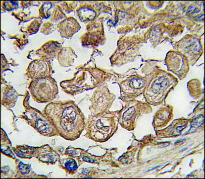 Anti-SIGLEC11 (C-term) antibody produced in