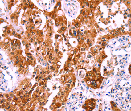 Anti-NCEH1 antibody produced in rabbit