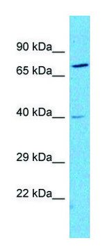 Anti-NPY2R (N-terminal) antibody produced in