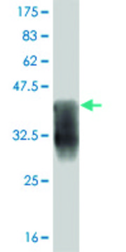 ANTI-T antibody produced in mouse