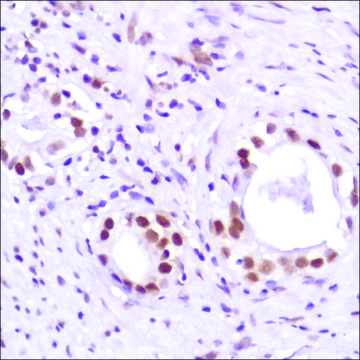 Anti-Androgen Receptor (C-term) antibody, Rabbit