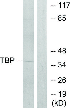 Anti-TBP antibody produced in rabbit