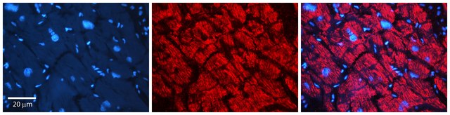 Anti-AKR1B1 antibody produced in rabbit
