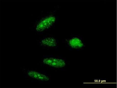 Anti-RTCD1 antibody produced in mouse
